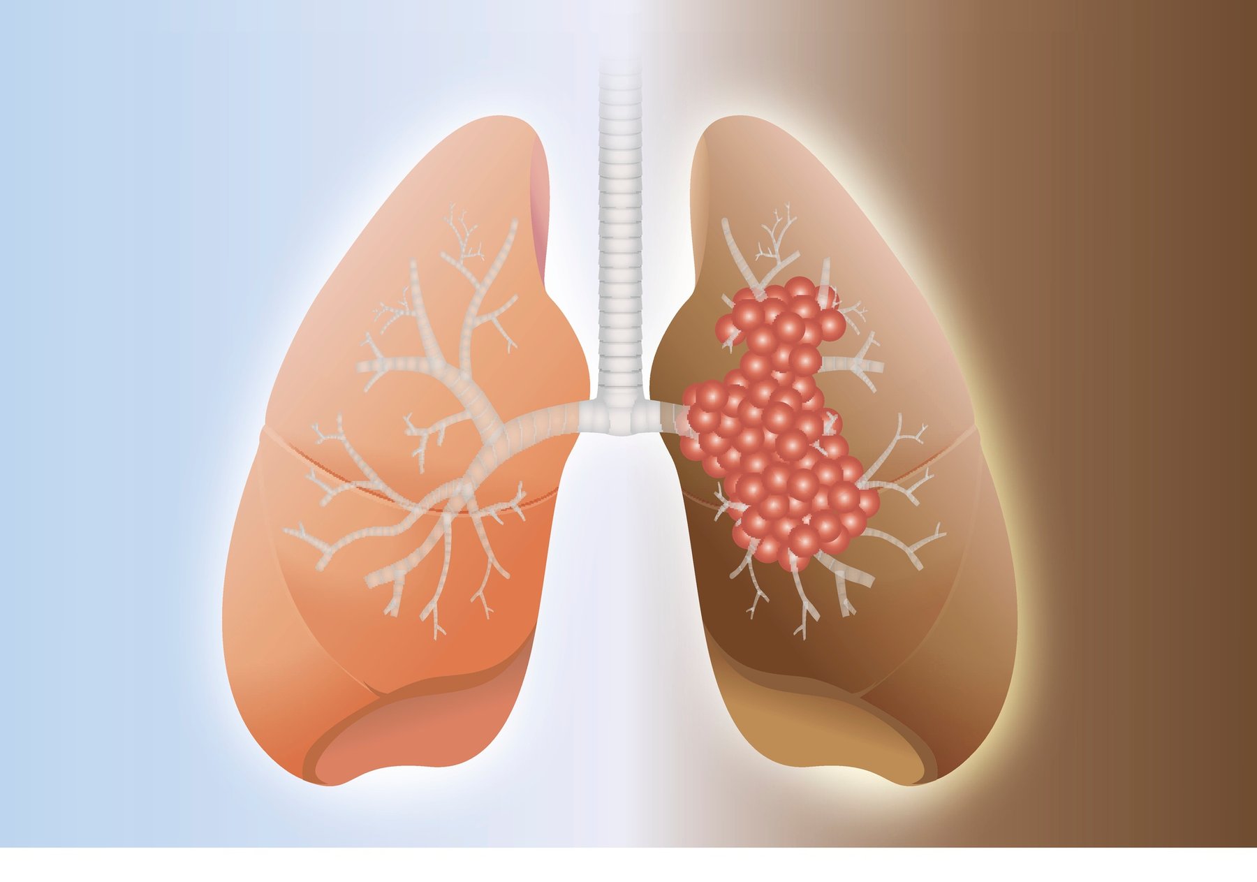 the-importance-of-suction-in-pulmonary-aspiration-emergencies